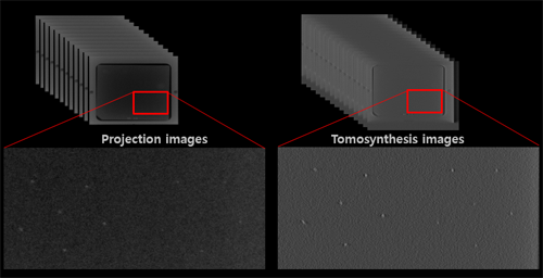 Tomosynthesis.png