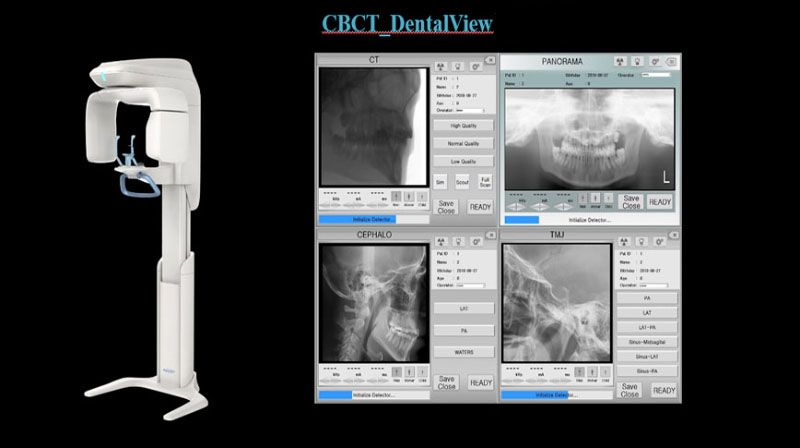 CBCT1.jpg