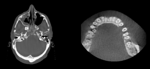 CBCT3.png