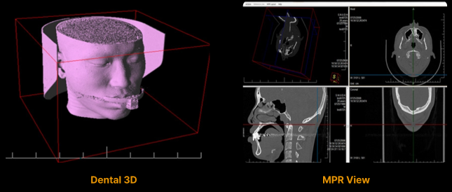 CBCT6.png