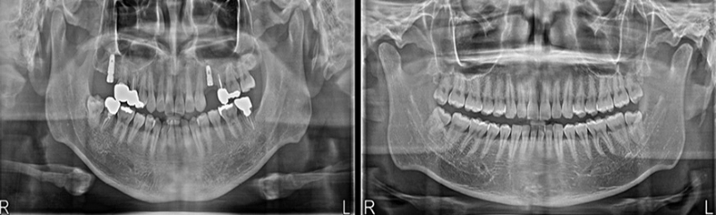CBCT7.jpg