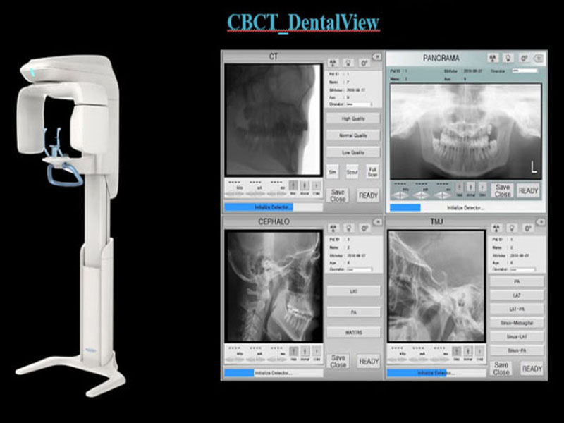 CBCT