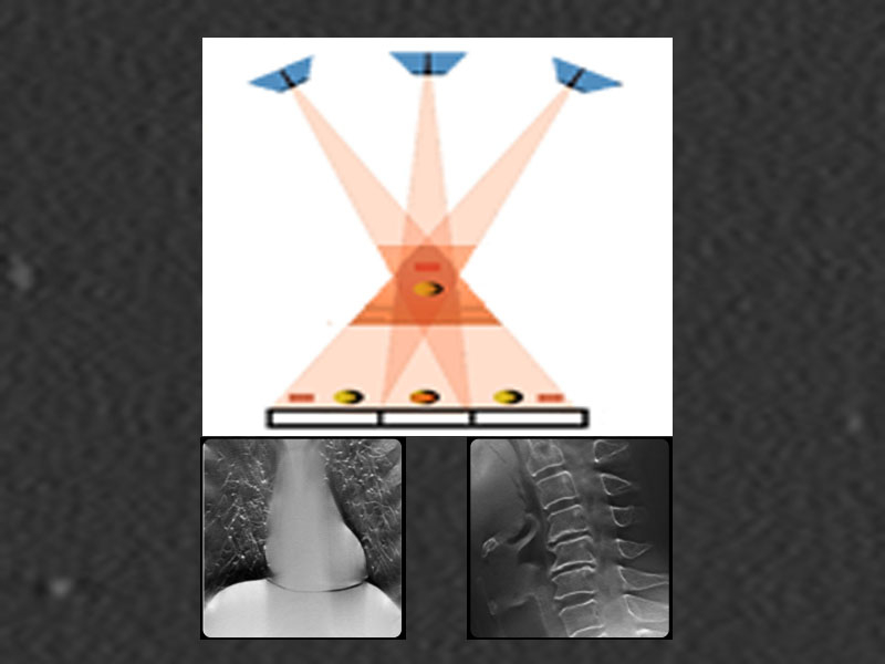 Tomosynthesis